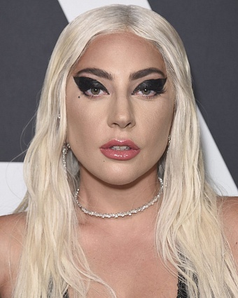 Из простушки в королеву: как Леди Гага изменилась за 12 лет (мнение хирурга) фото № 8