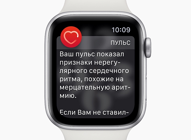 Apple Watch теперь смогут проверить ваше сердце (обязательно обновитесь)