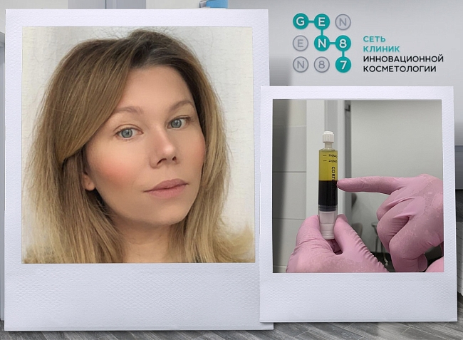 Катерина Суханова протестировала плазмотерапию и Dermadrop кожи головы в клинике инновационной косметологии Gen87 фото № 4