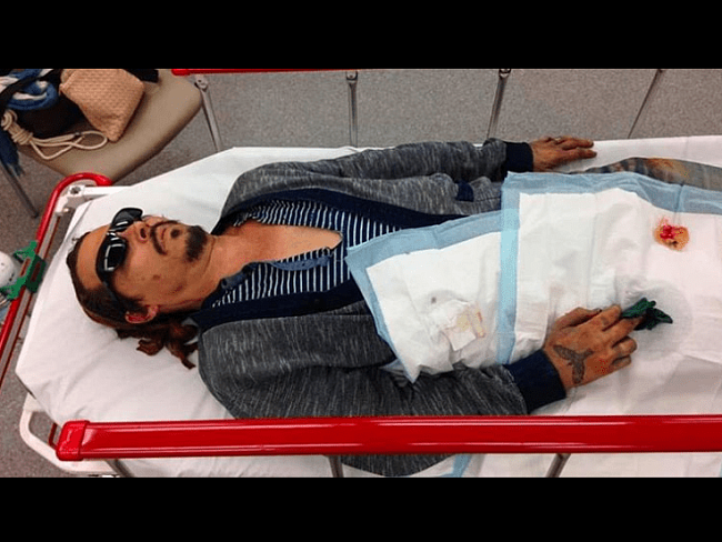 След от окурка и раненый палец: Джонни Депп показал фото после избиения экс-супругой фото № 1