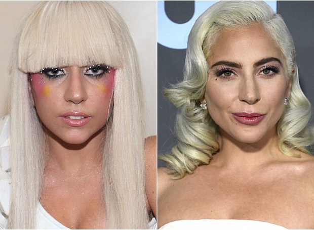 Из простушки в королеву: как Леди Гага изменилась за 12 лет (мнение хирурга)